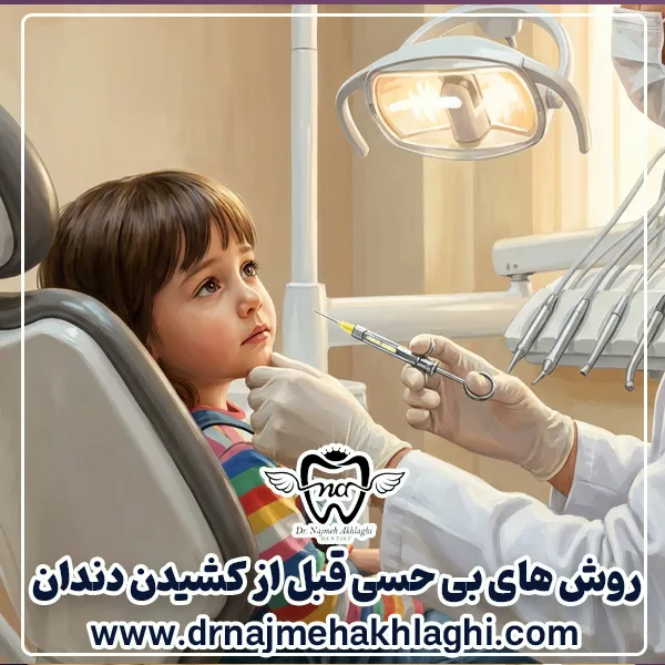 روش های بی حسی قبل از کشیدن دندان کودک