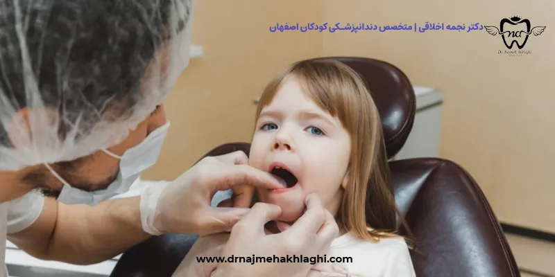 ارزیابی پروگنوز دندان شیری کودک پیش از درمان پالپ (عصب‌کشی)