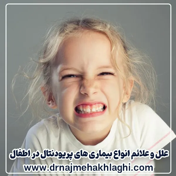 دندان قروچه در کودکان