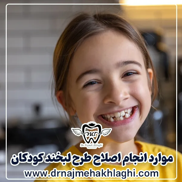 موارد انجام اصلاح طرح لبخند کودکان