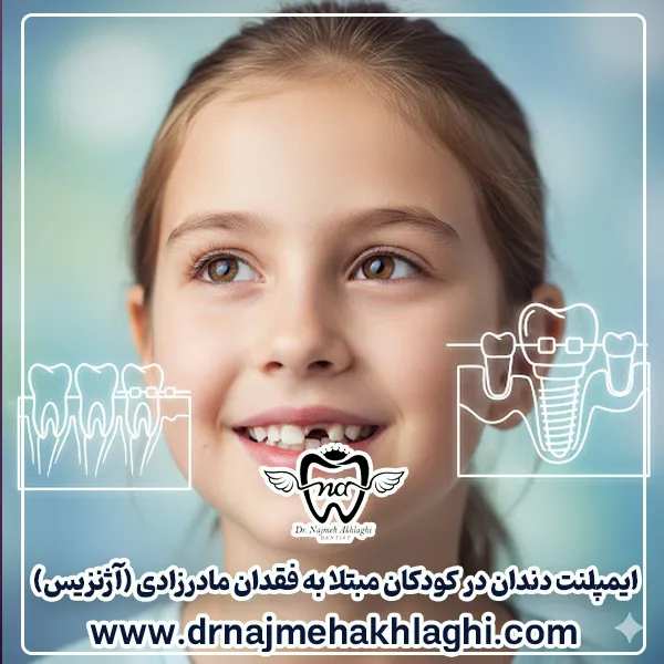ایمپلنت دندان در کودکان مبتلا به فقدان مادرزادی (آژنزیس)