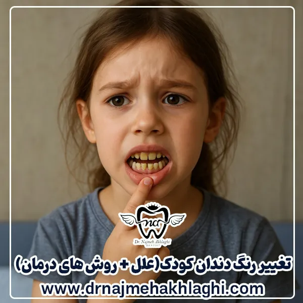 تغییر رنگ دندان در کودکان