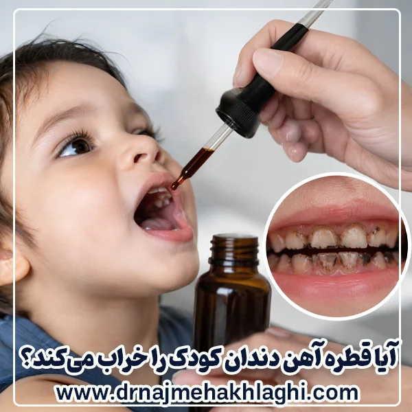قطره آهن دندان کودک را خراب می‌کند؟