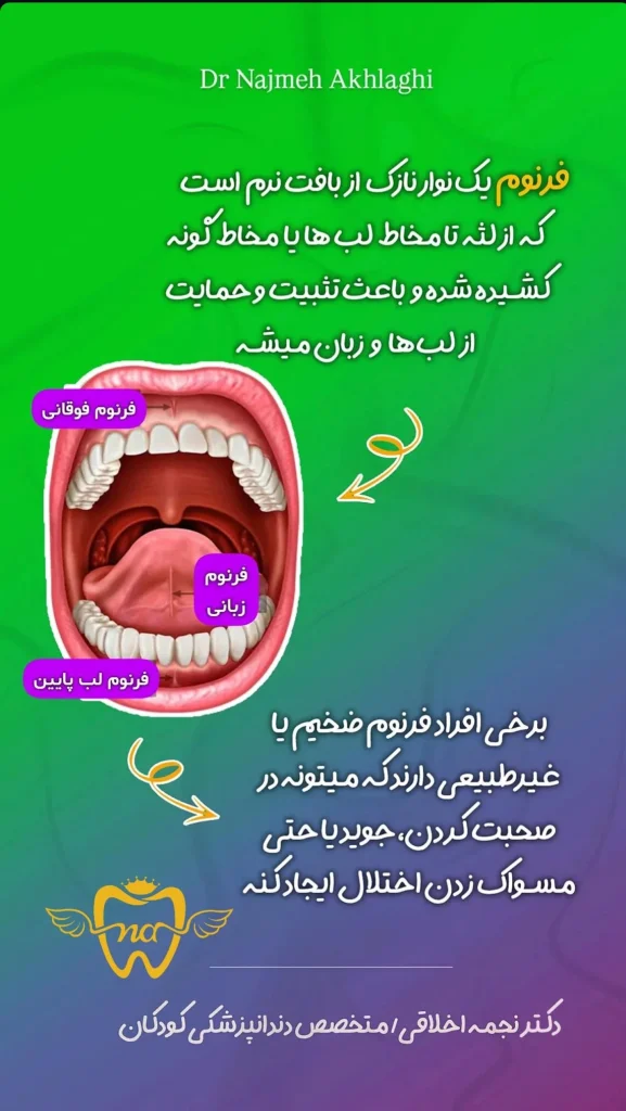 فرنکتومی زبان چیست؟