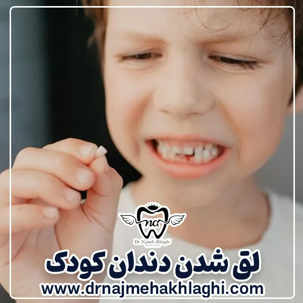 دندان لق در کودکان
