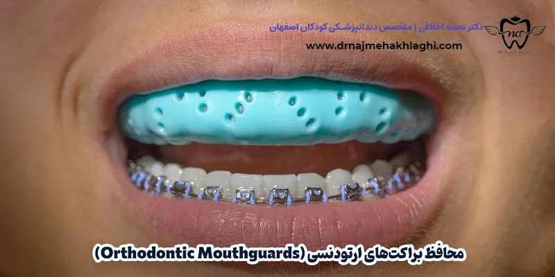 محافظ براکتهای ارتودنسی (Orthodontic Mouthguards)