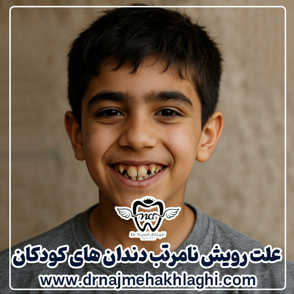 علت نامرتبی دندان کودک