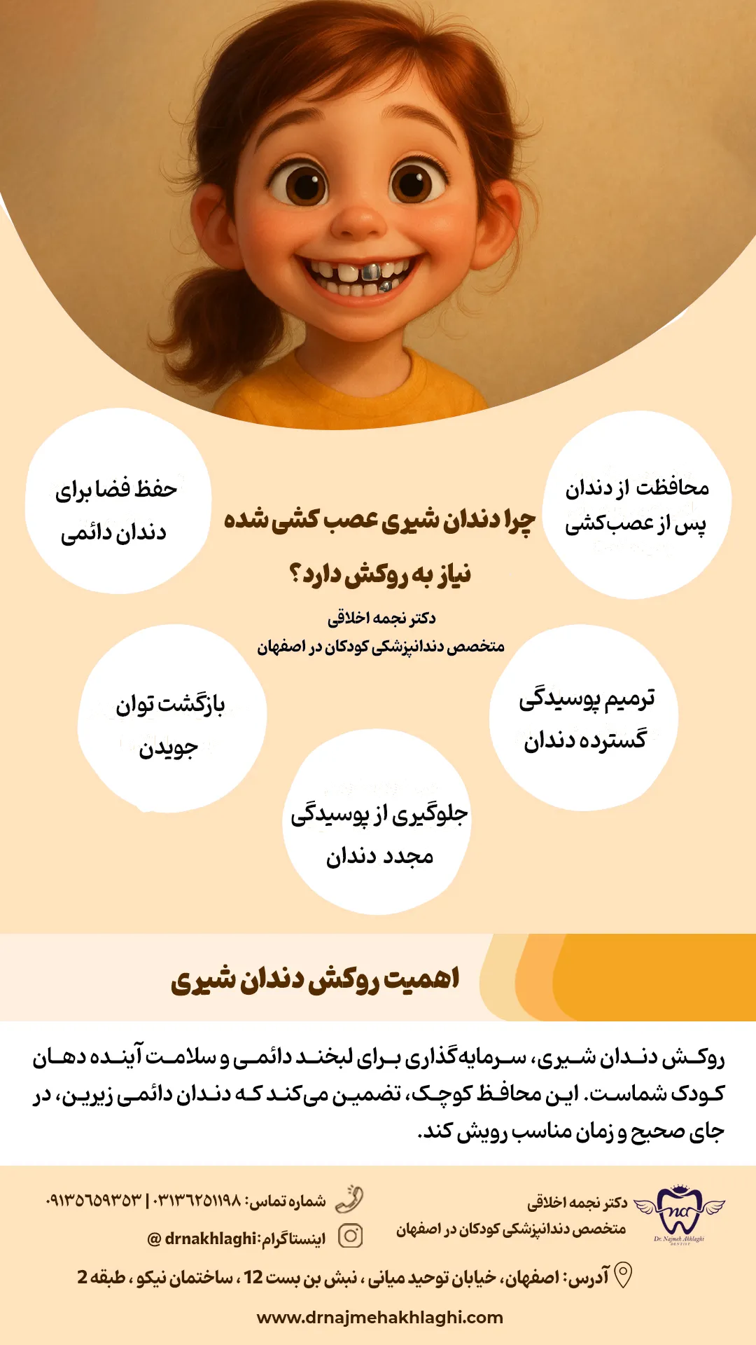 روکش دندان شیری در اصفهان