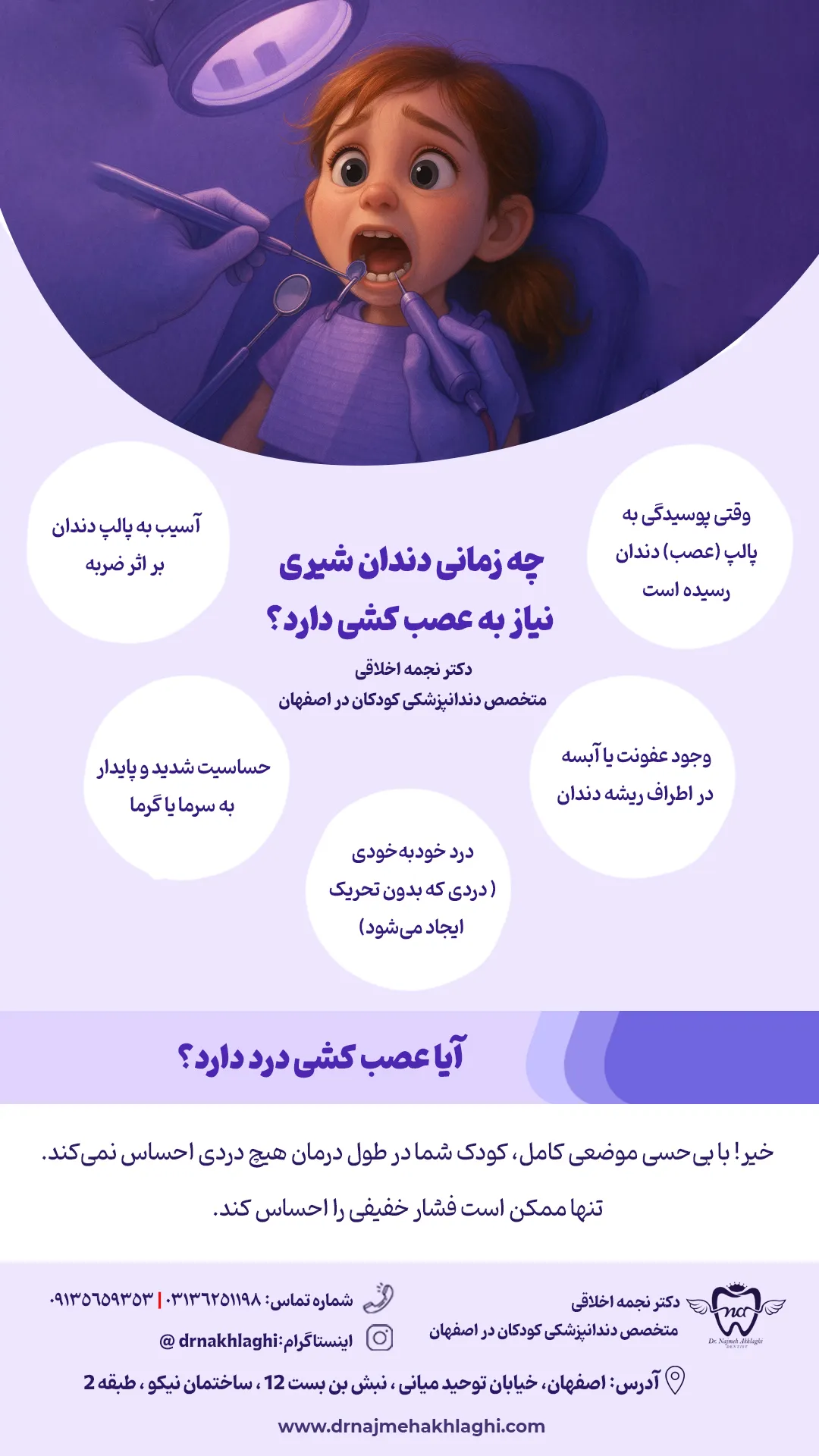 عصب کشی دندان شیری در اصفهان