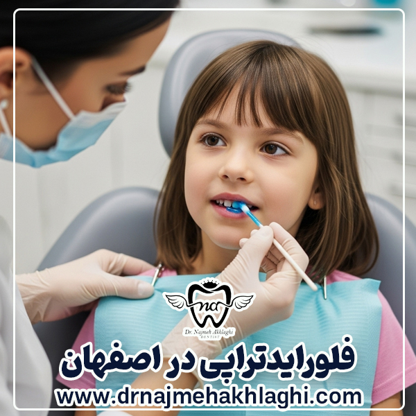 فلورایدتراپی در اصفهان