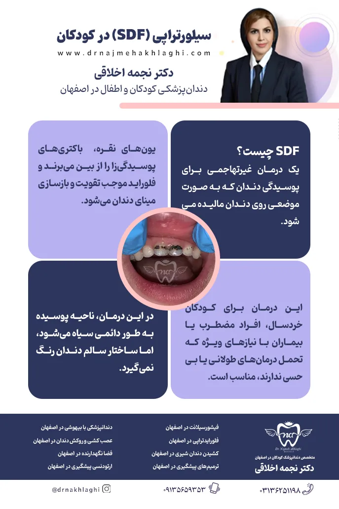 اینفوگرافی درمان پوسیدگی دندان با سیلورتراپی در اصفهان