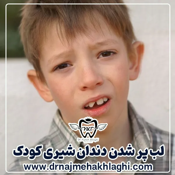 لب پر شدن دندان شیری کودک