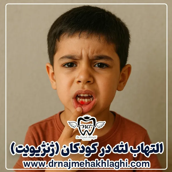 التهاب لثه در کودکان