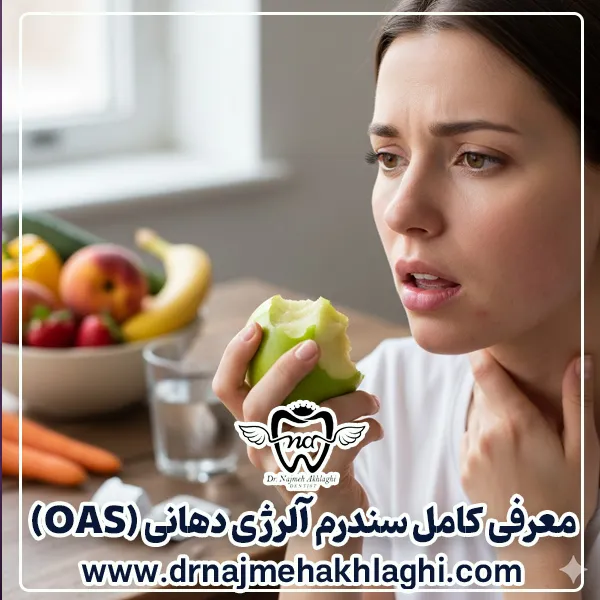 سندروم آلرژی دهانی