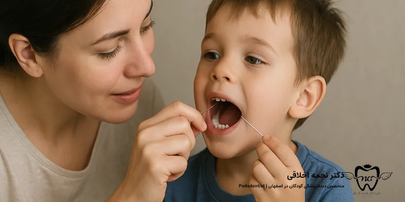 اهمیت کشیدن نخ دندان برای کودکان