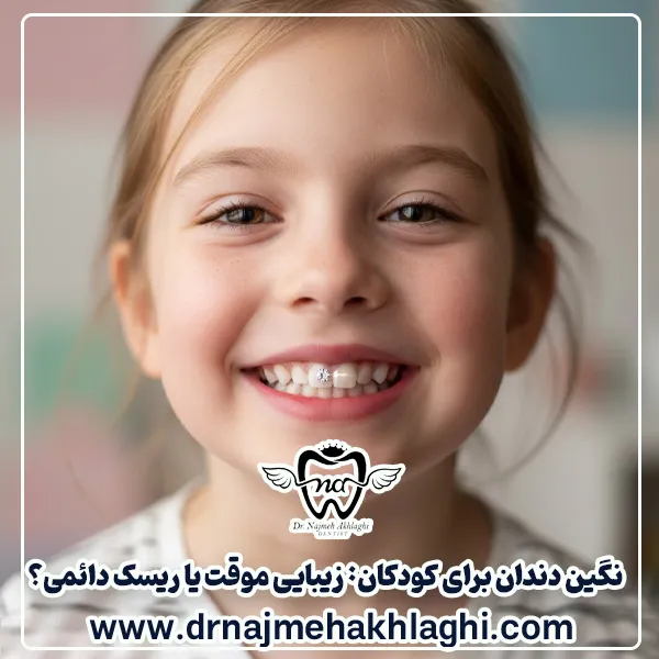 کاشت نگین دندان برای کودکان
