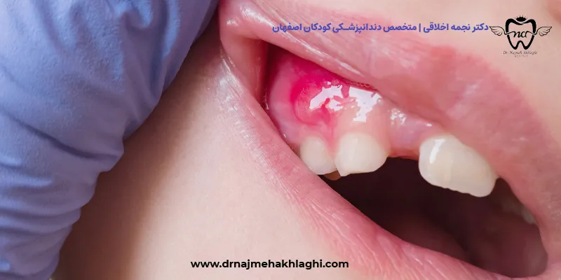 علائم و نشانه‌هایی که باید به آن‌ها توجه کنید