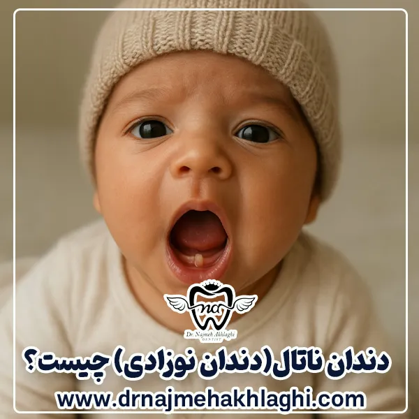 دندان ناتال(دندان نوزادی) چیست؟