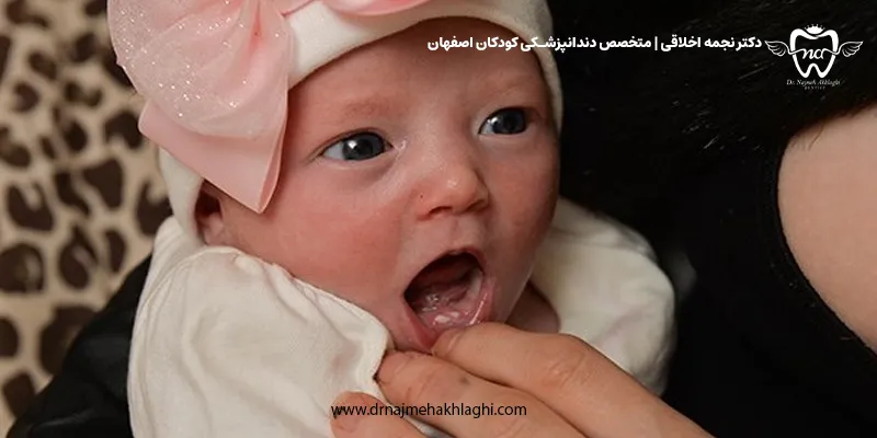 چرا کودکم با دندان به دنیا آمده است؟