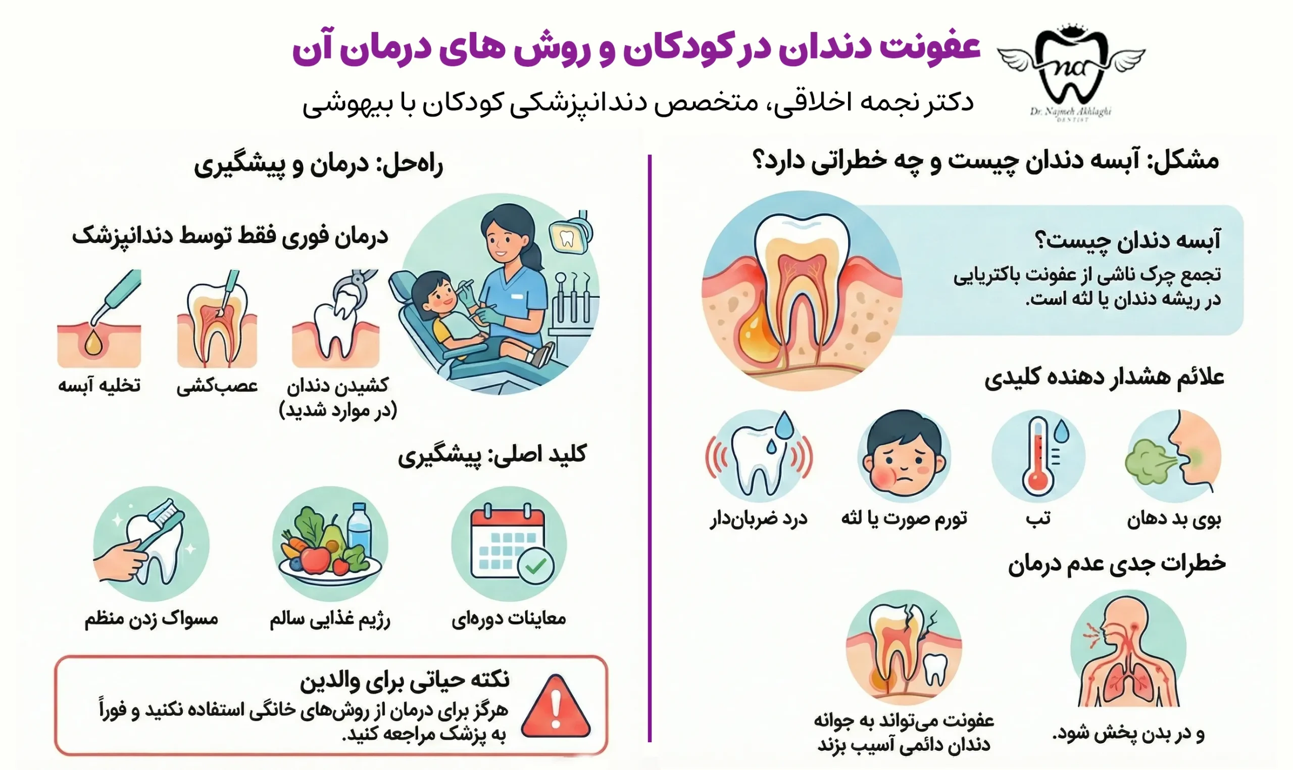 عفونت و آبسه دندان شیری کودکان و روش های درمان آن