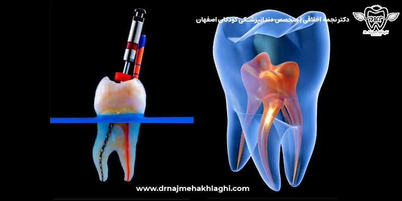 مضرات عضب کشی دندان شیری کودک