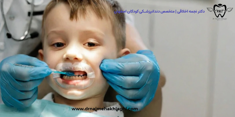 فلورایدتراپی در اصفهان