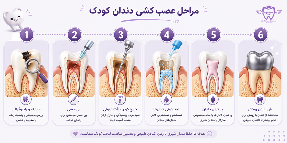 مراحل عصب کشی دندان شیری کودک در اصفهان